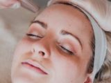 Microneedling Gold Coast