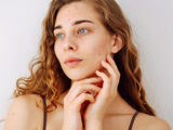 Acne Treatment