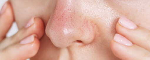 Close Up Of Woman With Sensitive Skin 640x480